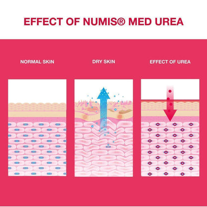 numis med UREA 10% foot cream, 100 ml